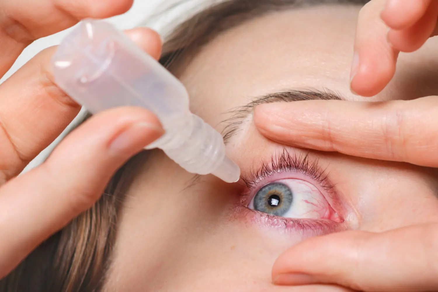 allergic reaction to eyelash extensions